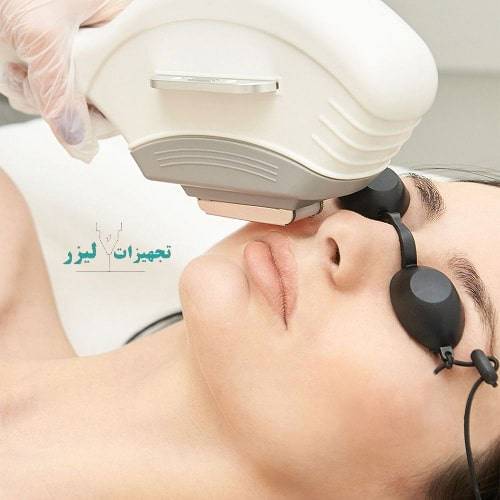 Laser facial hair removal - همه چیز درباره لیزر موهای زائد صورت؛ مزایا و عوارض